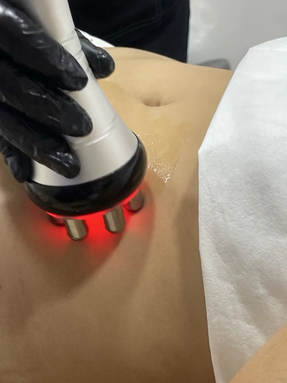 Moldeamiento Corporal